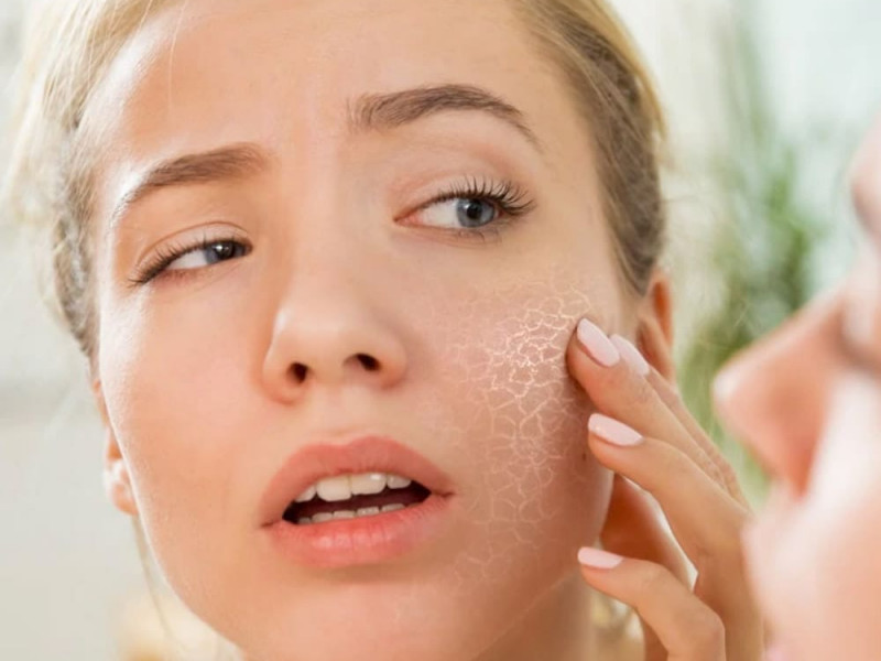 Oily dehydrated skin: how to properly care