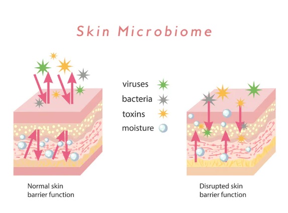 The Symptoms of a disrupted skin microbiome